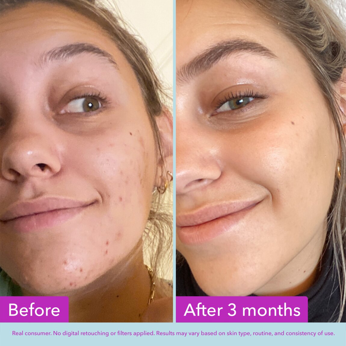 niacinamide-brightening-toner-u3 zb_p.jpg
