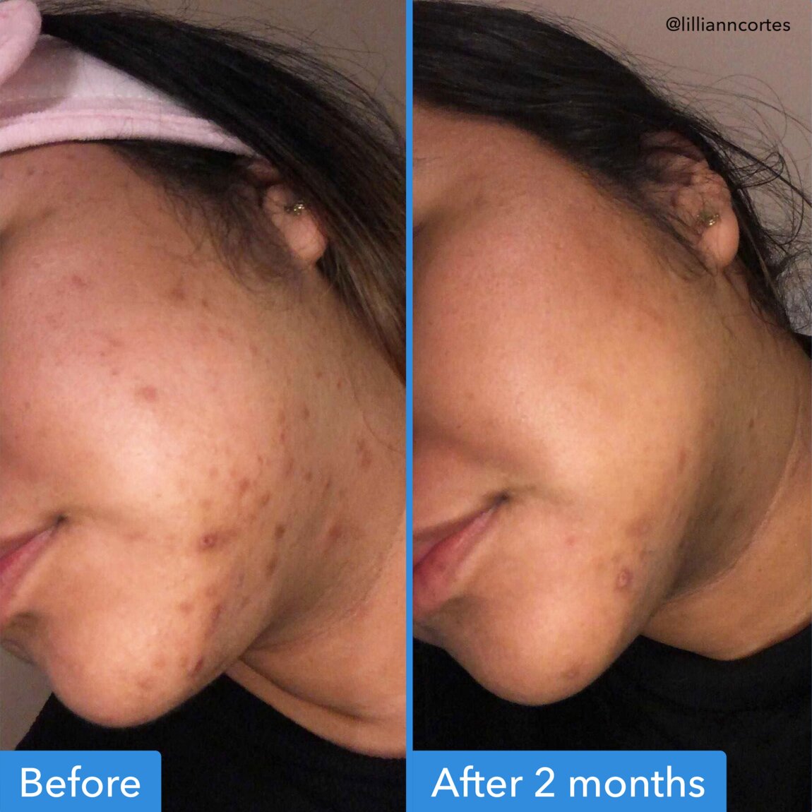 discoloration-correcting-serum-x2 zb_p.jpg